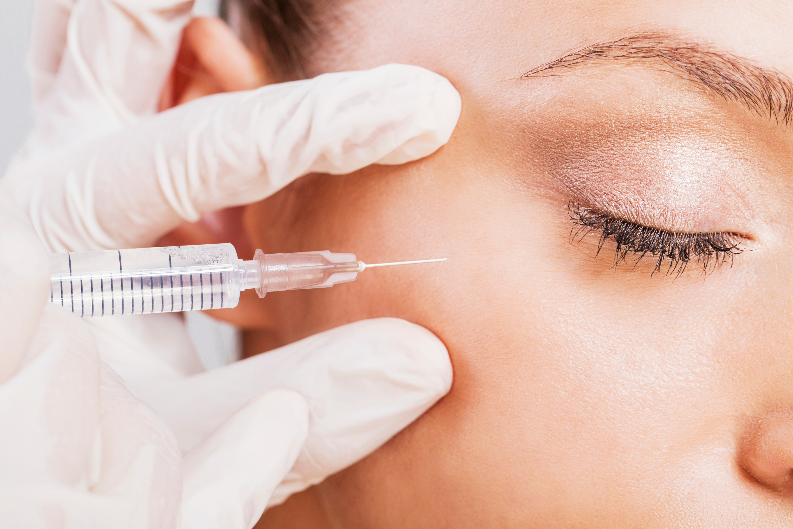 Neuromodulators (Botox)