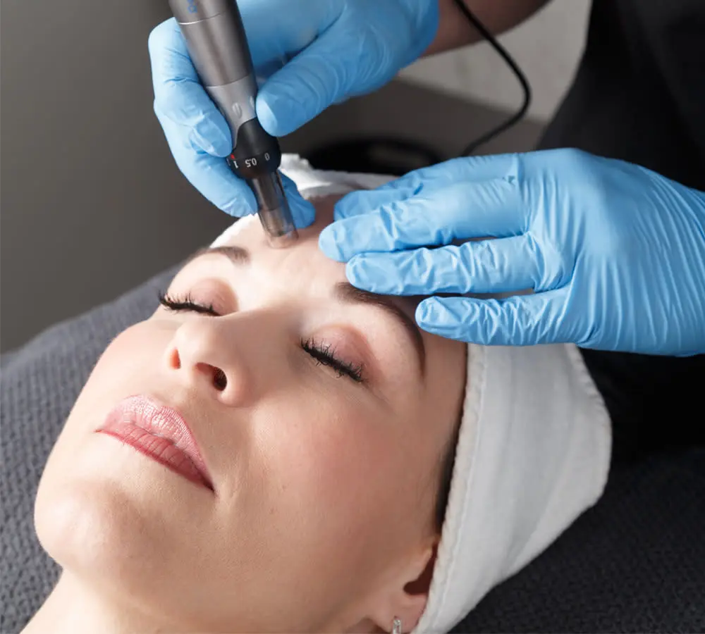 Micro Needling